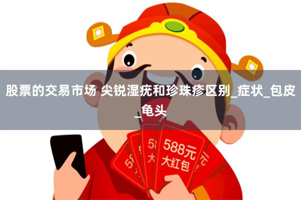 股票的交易市场 尖锐湿疣和珍珠疹区别_症状_包皮_龟头